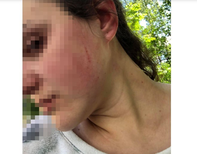 У Тернополі чоловік через собаку побив жінку на очах у її 10-місячної доньки (ФОТО)