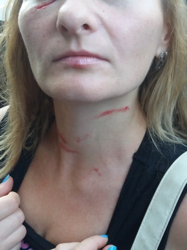 На Тернопільщині медсестра побила маму, яка захищала свого сина (ФОТО 18+)