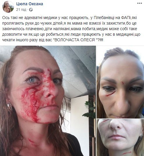 На Тернопільщині медсестра побила маму, яка захищала свого сина (ФОТО 18+)