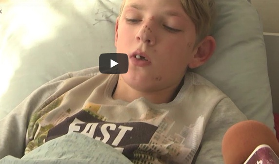 “Зайшли в Інтернет і… отямилися в лікарні”: діти з Тернопільщини розповіли, як отримали переломи (ВІДЕО)