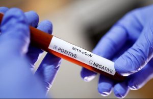 Канадські науковці виявили збудника коронавірусу