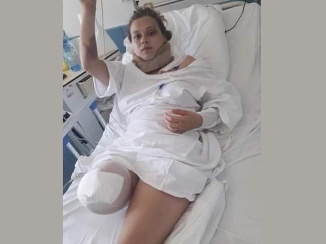 Трагедія через п’яну водійку: постраждала дівчина з Монастирищини