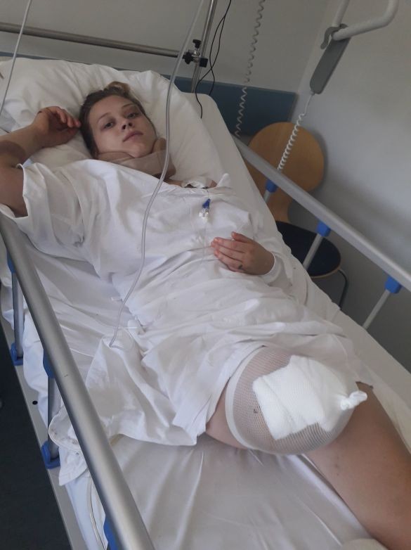 “Дівчині відірвало ногу, хлопець загинув – вся траса у крові”: у Польщі трапилась страшна аварія з українцями (ФОТО)