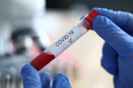 Ситуація із коронавірусом: Тернопільщина в 6,5 разів перевищує допустиму норму