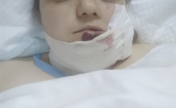 “На обличчі немає “живого” місця, воно порізане, а біль пекелний”: жінка з Тернопільщини потребує допомоги