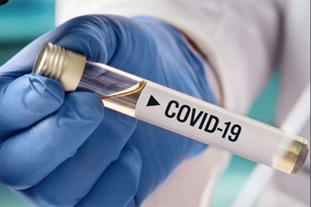 На Тернопільщині за добу 276 хворих на коронавірус та 3 летальних випадки